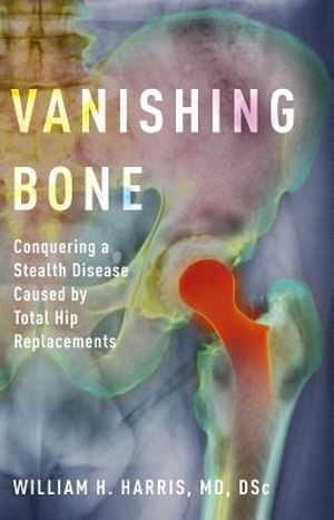 Vanishing Bone: Conquering a Stealth Disease Caused by Total Hip Replacements image number 0
