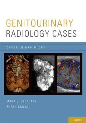 Genitourinary Radiology Cases image number 0