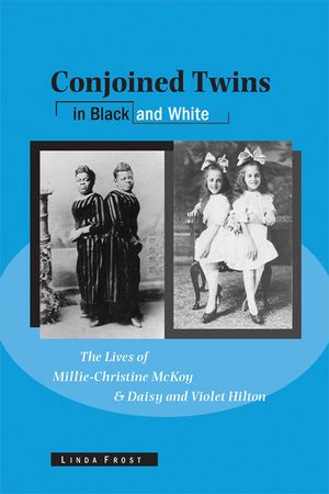 Conjoined Twins in Black and White: The Lives of Millie-Christine McKoy and Daisy and Violet Hilton image number 0