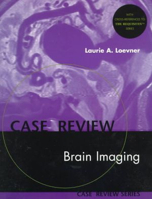 Brain Imaging: Case Review Series image number 0