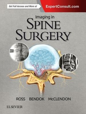 Imaging in Spine Surgery image number 0