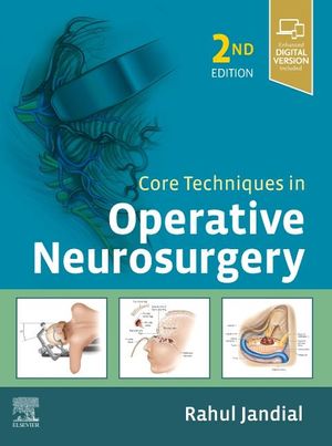 Core Techniques in Operative Neurosurgery image number 0
