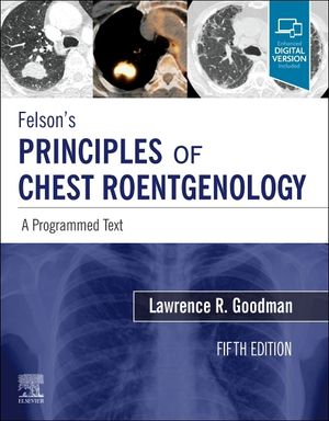 Felson's Principles of Chest Roentgenology, a Programmed Text: A Programmed Text image number 0