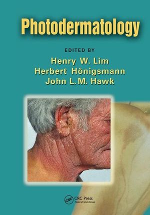 Photodermatology image number 0
