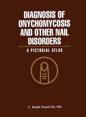 Diagnosis of Onychomycosis and Other Nail Disorders: A Pictorial Atlas image number 0