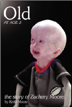 Old at Age 3 : The Story of Zachary Moore image number 0