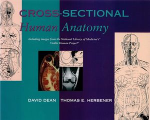 Cross-Sectional Human Anatomy image number 0