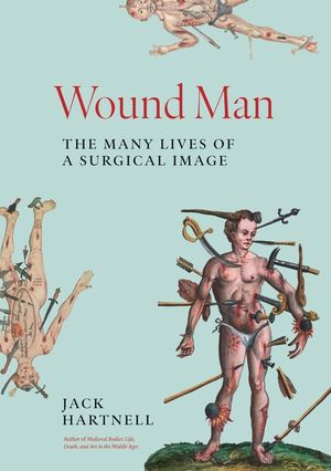 Wound Man: The Many Lives of a Surgical Image image number 0