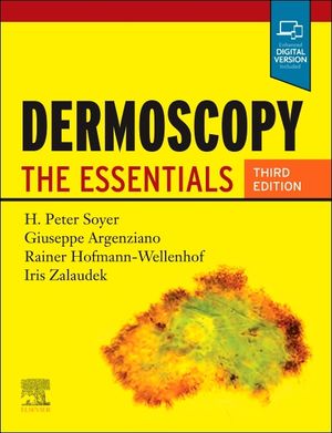 Dermoscopy: The Essentials image number 0