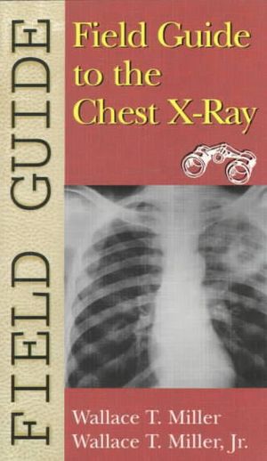 Field Guide to the Chest X-Ray image number 0