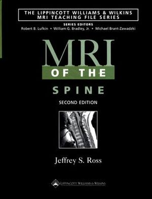 MRI of the Spine image number 0
