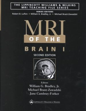 MRI of the Brain 1 image number 0