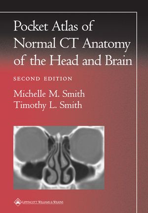 Pocket Atlas of Normal CT Anatomy of the Head and Brain image number 0