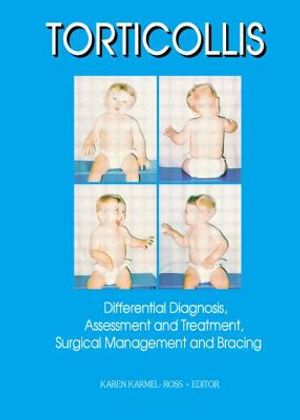 Torticollis: Differential Diagnosis, Assessment and Treatment, Surgical Management and Bracing image number 0