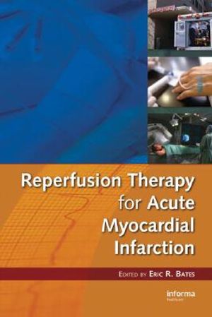 Reperfusion Therapy for Acute Myocardial Infarction image number 0