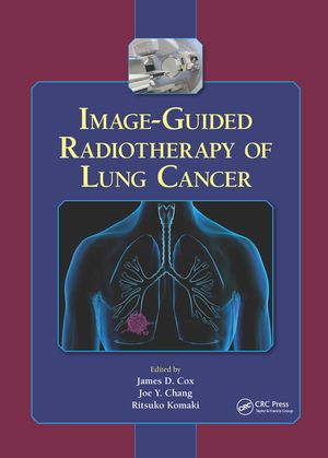 Image-Guided Radiotherapy of Lung Cancer image number 0