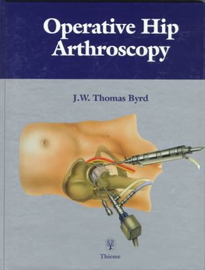 Operative Hip Arthroscopy: image number 0