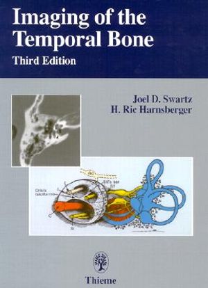 Imaging of the Temporal Bone image number 0