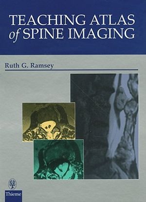 Teaching Atlas of Spine Imaging image number 0