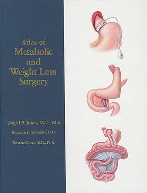 Atlas of Metabolic and Weight Loss Surgery image number 0