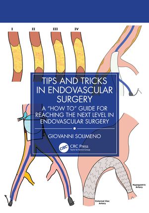 Tips and Tricks in Endovascular Surgery: A How to Guide for Reaching the Next Level in Endovascular Surgery image number 0