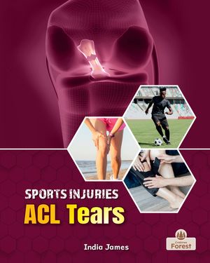 ACL Tears image number 0