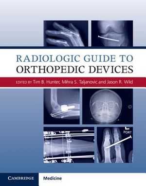 Radiologic Guide to Orthopedic Devices image number 0
