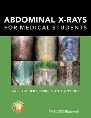 Abdominal X-Rays for Medical Students image number 0