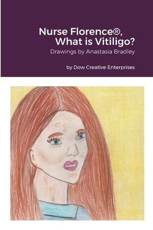 Nurse Florence(R), What is Vitiligo? image number 0