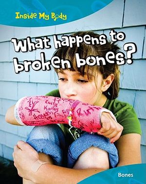 What Happens to Broken Bones?: Bones image number 0