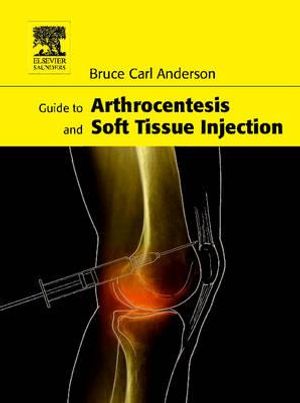 Guide to Arthrocentesis and Soft Tissue Injection image number 0