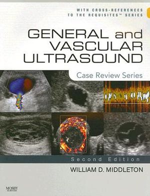 General and Vascular Ultrasound: Case Review Series image number 0