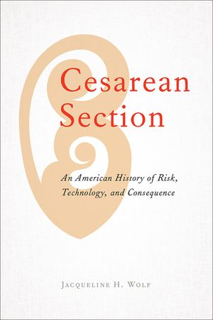 Cesarean Section: An American History of Risk, Technology, and Consequence image number 0