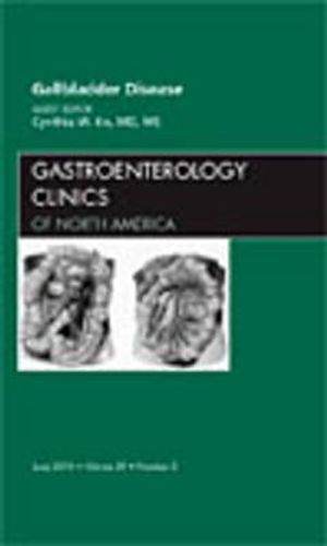 Gallbladder Disease, an Issue of Gastroenterology Clinics, 39 image number 0