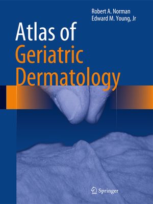 Atlas of Geriatric Dermatology image number 0