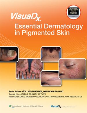 Visualdx: Essential Dermatology in Pigmented Skin image number 0