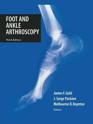 Foot and Ankle Arthroscopy image number 0