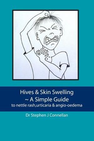 Hives & Skin Swelling A Simple Guide: to nettle rash, urticaria & angio-oedema image number 0