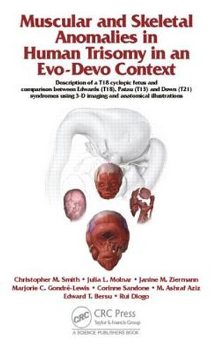 Muscular and Skeletal Anomalies in Human Trisomy in an Evo-Devo Context: Description of a T18 Cyclopic Fetus and Comparison Between Edwards (T18), Pat image number 0