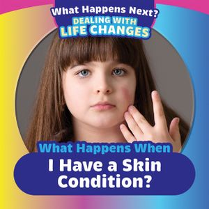 What Happens When I Have a Skin Condition? image number 0