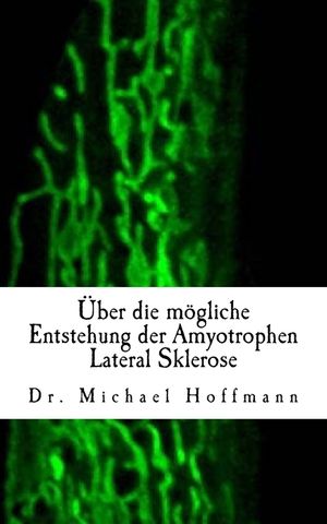 &Uuml;ber die m&ouml;gliche Entstehung der Amyotrophen Lateral Sklerose image number 0