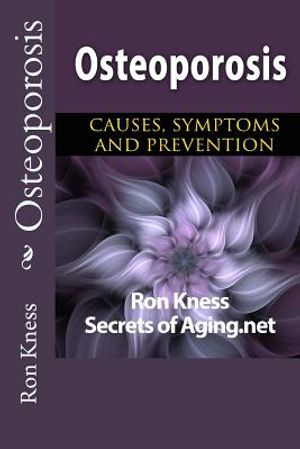 Osteoporosis: Causes, Symptoms and Prevention image number 0