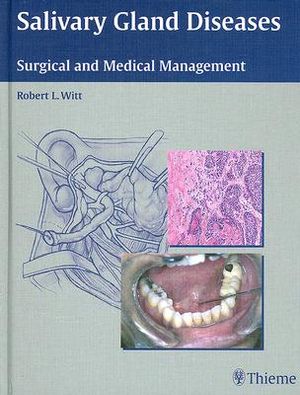 Salivary Gland Diseases: Surgical and Medical Management image number 0