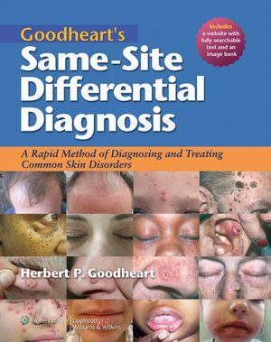 Goodheart's Same-Site Differential Diagnosis: A Rapid Method of Diagnosing and Treating Common Skin Disorders [With Free Web Access] image number 0
