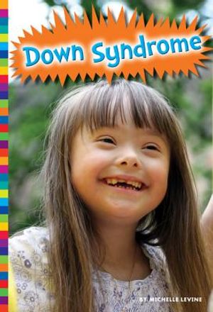 Down Syndrome image number 0