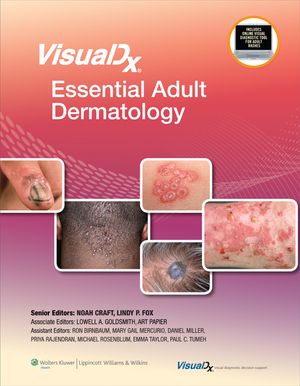 Visualdx: Essential Adult Dermatology image number 0