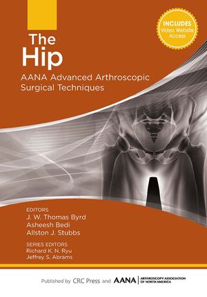 The Hip: Aana Advanced Arthroscopic Surgical Techniques image number 0