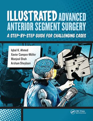 Illustrated Advanced Anterior Segment Surgery: A Step-By-Step Guide for Challenging Cases image number 0