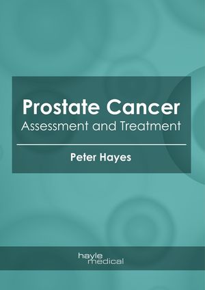 Prostate Cancer: Assessment and Treatment image number 0