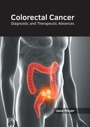 Colorectal Cancer: Diagnostic and Therapeutic Advances image number 0